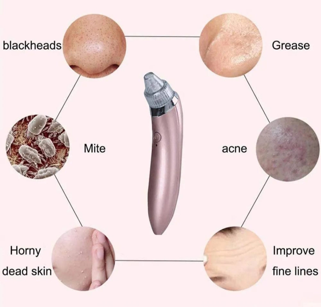 DermaSuction - Extractor de Puntos Negros