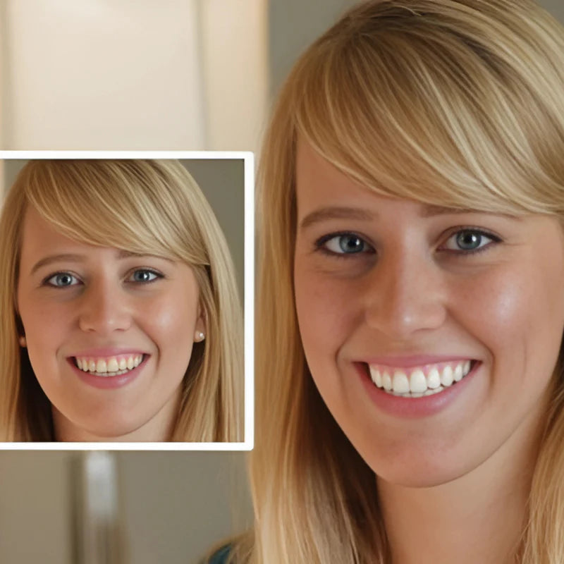 KIT BLANQUEADOR DENTAL – Sonríe con seguridad y dientes visiblemente más blancos