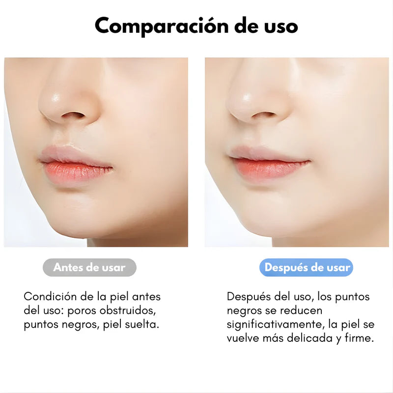 ESPÁTULA LIMPIADOR FACIAL ULTRASÓNICO – Limpieza profunda, poros más finos y piel suave sin irritación